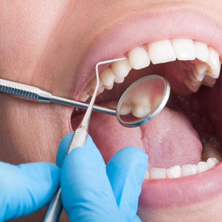 tooth sensivity treatment in Guntur